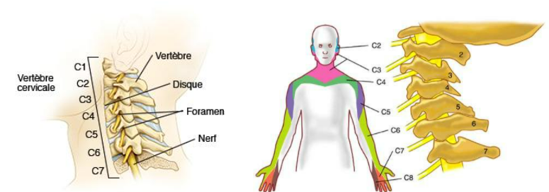 Hernie discale cervicale – Uperform