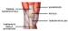 Comprendre la tendinopathie rotulienne